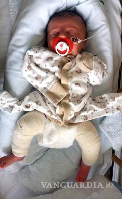 $!Conoce la historia del "niño de cristal"; un simple estornudo podría enviarlo al hospital