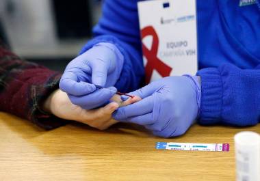 Los casos de VIH en la entidad se han disparado drásticamente en más de mil por ciento.