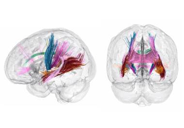 Estudios en los que se escaneó el cerebro de las mujeres antes y después del embarazo han revelado que ciertas redes cerebrales.