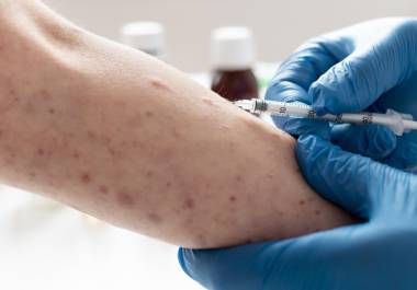 Autoridades de salud mantienen campañas permanentes para reforzar esquemas y contener contagios de sarampión.