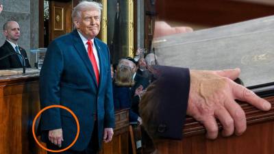 Las recientes apariciones públicas del presidente estadounidense reavivaron cuestionamientos sobre su estado físico, luego de que una mancha visible en su mano fuera captada durante un discurso oficial.