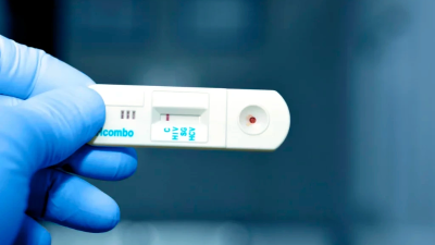 En contraste, los contagios de herpes genital experimentaron una disminución en el mismo periodo.