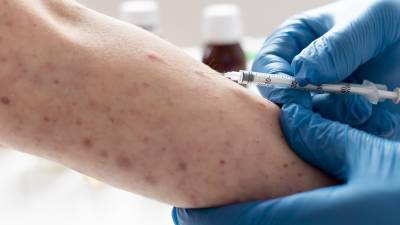 Autoridades de salud mantienen campañas permanentes para reforzar esquemas y contener contagios de sarampión.