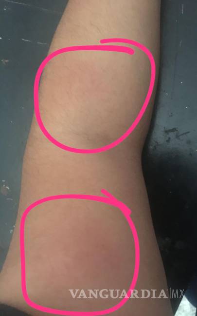 Paramédico de la Cruz Roja de Saltillo viola orden de restricción y agrede a ex pareja