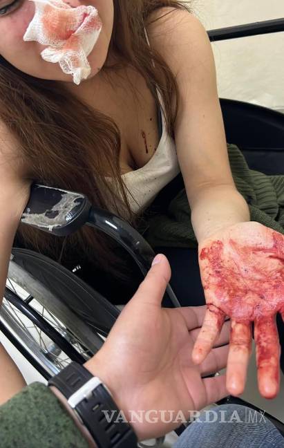 Denuncian a ex policía de Saltillo por violentar a su pareja; agresor huye