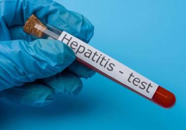 A nivel mundial, la hepatitis es lacusante de más de 100 mil fallecimientos al año.