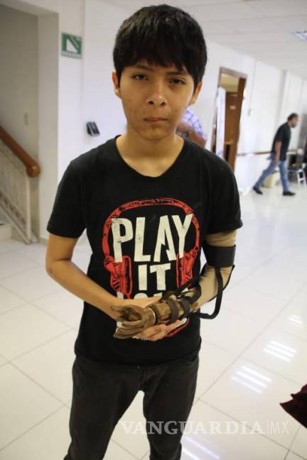 $!Carlos tiene 14 años y ayer fue beneficiado con una prótesis.