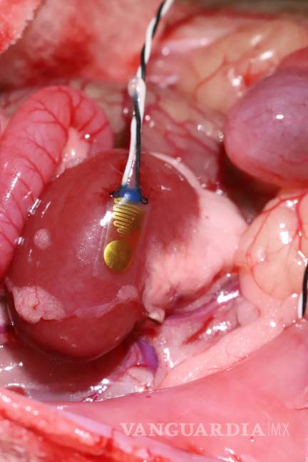 $!Dispositivo implantado en un riñón de roedor (cobayo).