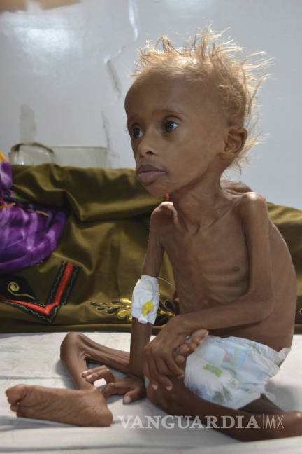 $!130 niños o más mueren cada día en Yemen: Save the Children