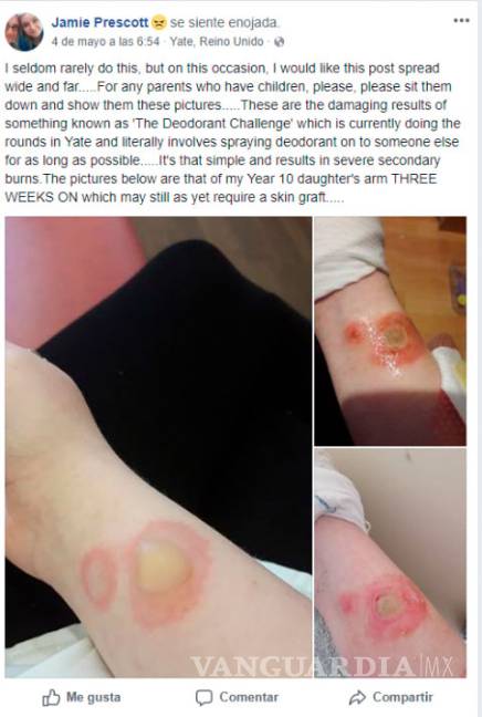 $!¿Quieres intentar el reto del desodorante? Piénsalo bien