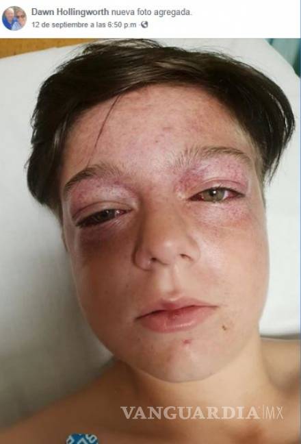 $!Niño sufre lesiones cerebrales tras realizar 'el carrusel de la muerte', un desafío de YouTube (Video)