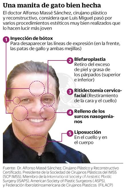 $!Luis Miguel llega a 47 con cirugías y demandas