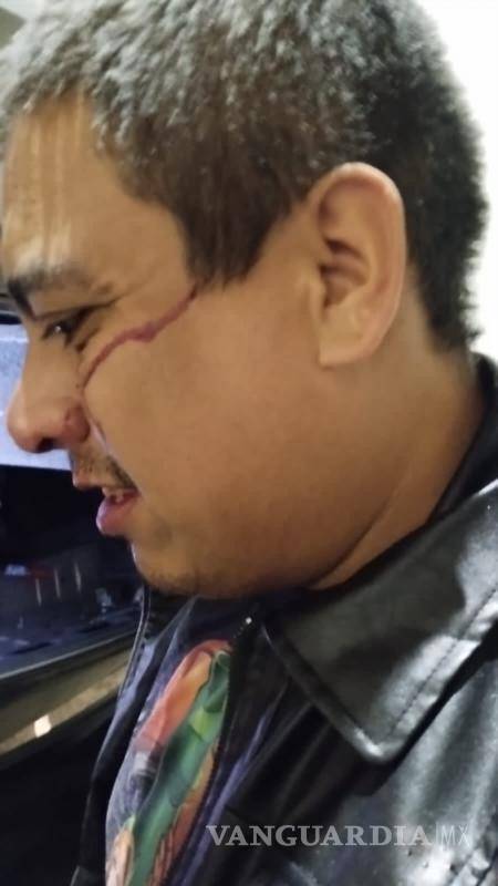 $!Rogelio decidió no ser trasladado a un hospital y permaneció en el lugar .