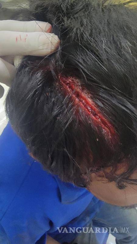 $!La familia de José Omar denunció el brutal ataque que sufrió a manos de un policía municipal, quien utilizó un bate para agredirlo.