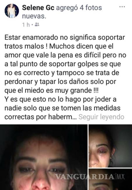 $!Denuncia mujer, fuerte agresión de hijo de conductor de Televisa Saltillo