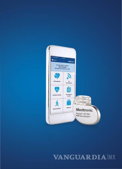 $!Marcapasos Azure con tecnología inalámbrica y 'app' de control. EFE/Medtronic