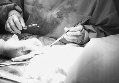 Un hombre de 57 años falleció mientras se sometía a una cirugía estética en una clínica del Obispado, en Monterrey; la causa de muerte será determinada por la autopsia