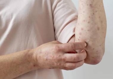 Los contagios se distribuyen en Torreón y Saltillo, con cuatro casos en cada ciudad.