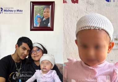 Jazlyn Azulet volvió a México después de recibir atención especializada por quemaduras graves en el Hospital Shriners de Galveston; la Fundación Michou y Mau acompañará su nueva etapa de rehabilitación.