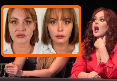 Cambios. La actriz venezolana se sometió a armonización facial, rellenadores y lifting, recibiendo opiniones divididas en redes sociales.