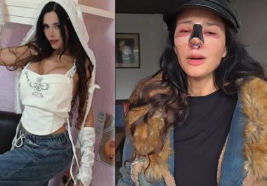 La reconocida modelo argentina y conductora de Televisa, Dora Noemí Kerchen, mejor conocida como Dorismar, denunció haber sido víctima de una “mala praxis” tras una cirugía estética.