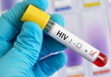El VIH puede permanecer años sin síntomas, lo que aumenta el riesgo de contagio si no se detecta a tiempo, alertan autoridades sanitarias.