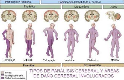 $!No todas las afecciones que la población atribuye al clima corresponden a una parálisis, aclara especialista.