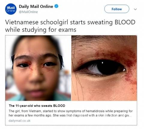 $!Niña vietnamita suda sangre por culpa de estrés escolar