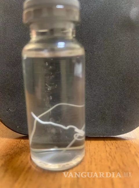 $!El hospital tomó la decisión de exhibir este gusano