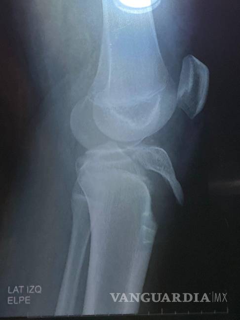 $!Padres denuncian que el colegio no siguió los protocolos de atención médica ni llamó a una ambulancia tras la lesión.