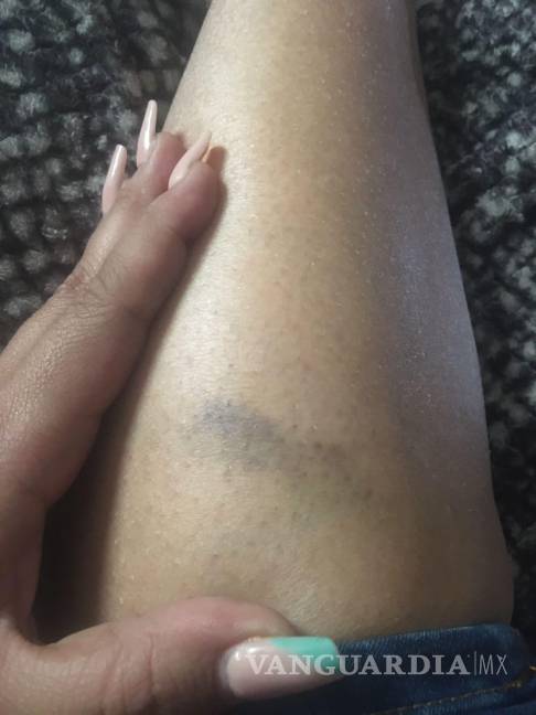 Paramédico de la Cruz Roja de Saltillo viola orden de restricción y agrede a ex pareja