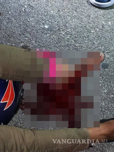 $!La víctima sufrió desprendimiento del talón y lesiones graves en el pie.