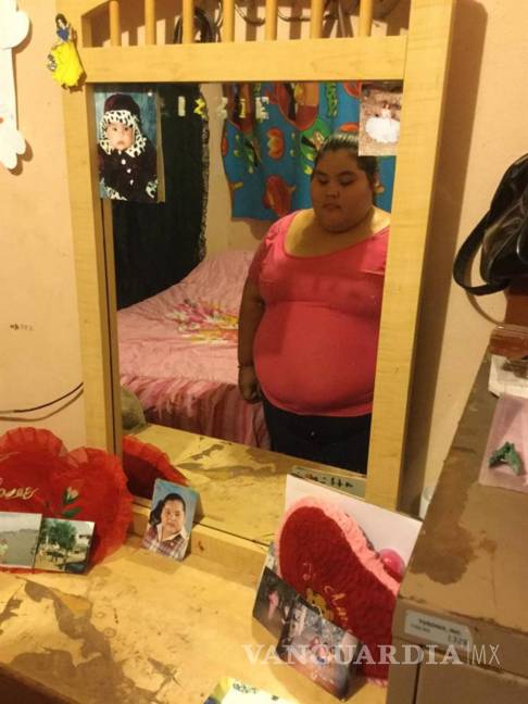 $!Dayana, 14 años, 195 kilos y un by-pass gástrico para mejorar su vida