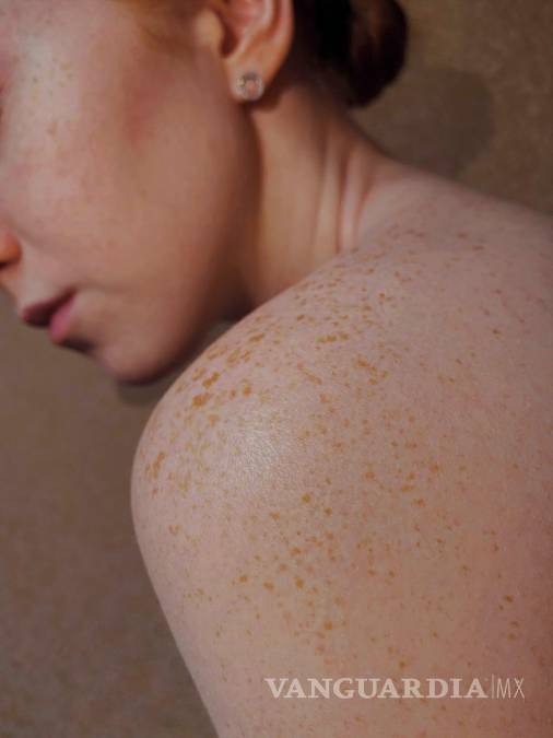 $!Hay cuatro tipos diferentes de piel: normal, seca, grasa y mixta.