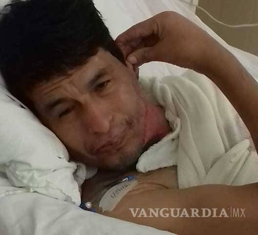 $!Rigo, el hombre con alma de niño que quemaron vivo en Cuatrociénegas