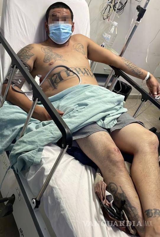 $!Apuñalan a joven en fiesta de Halloween, en la Mirasierra