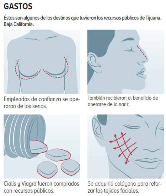 $!Edil de Tijuana paga cirugías estéticas a empleados
