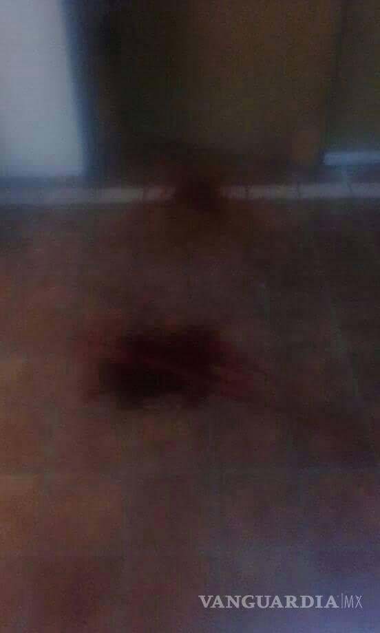 $!Denuncian que mujer muere desangrada en el IMSS de Parras por falta de atención