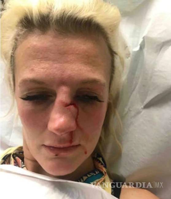 $!La brutal agresión de una peleadora de MMA a manos de su exnovio