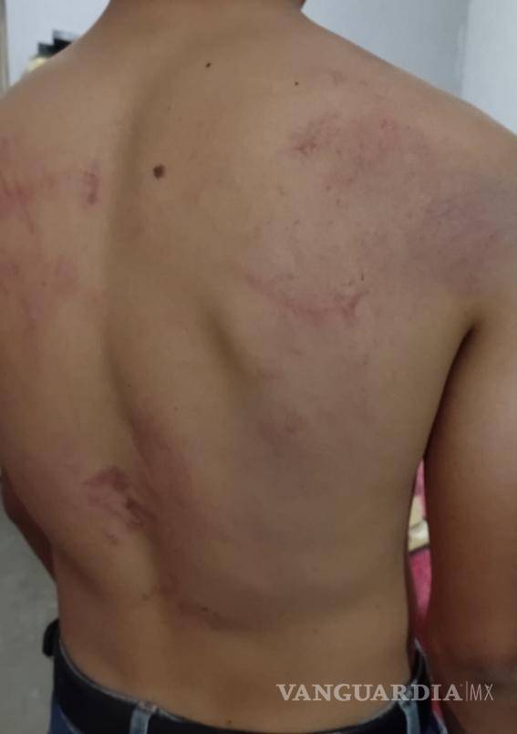 $!Tras recibir atención médica, el menor acudió al Ministerio Público para interponer la denuncia, preocupado principalmente por recuperar sus documentos personales.