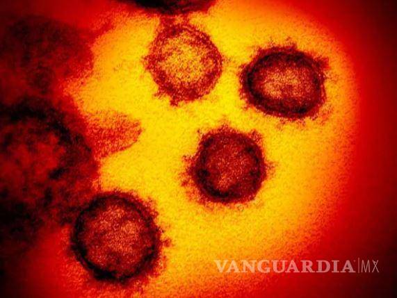 $!Primera imagen de la variante Ómicron del virus del SARS-Cpv-2. Foto: Hospital Bambino Gesù de Roma