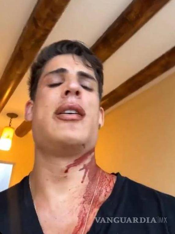 $!Novio de la mamá de Neymar es apuñalado en Cancún