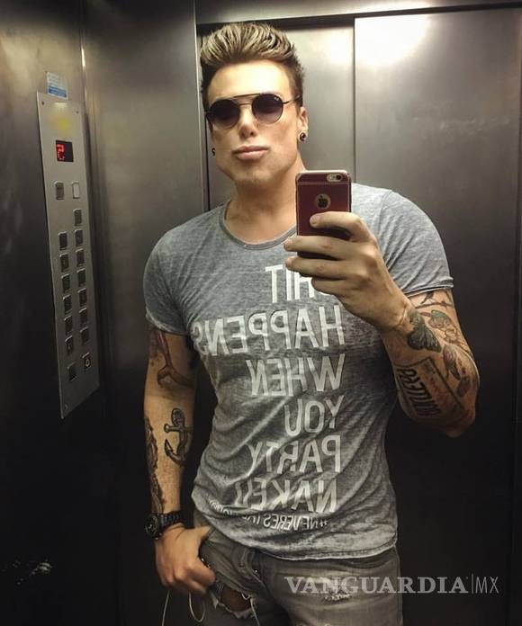 $!Por operarse la nariz obtuvo una dolorosa erección permanente