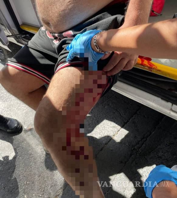 Hieren a trabajador de centro de rehabilitación cuando intentaba anexar a paciente, en Nuevo León