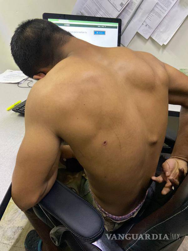 $!El joven de 24 años fue atendido en el Hospital Amparo Pape de Benavides, donde permaneció cinco días hospitalizado.