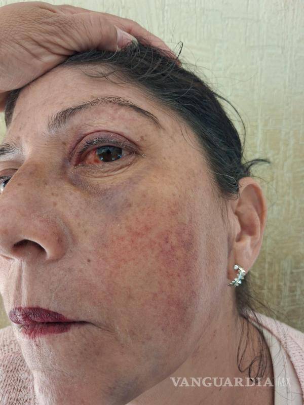 $!La víctima recibe atención médica por lesiones internas y daño auditivo.