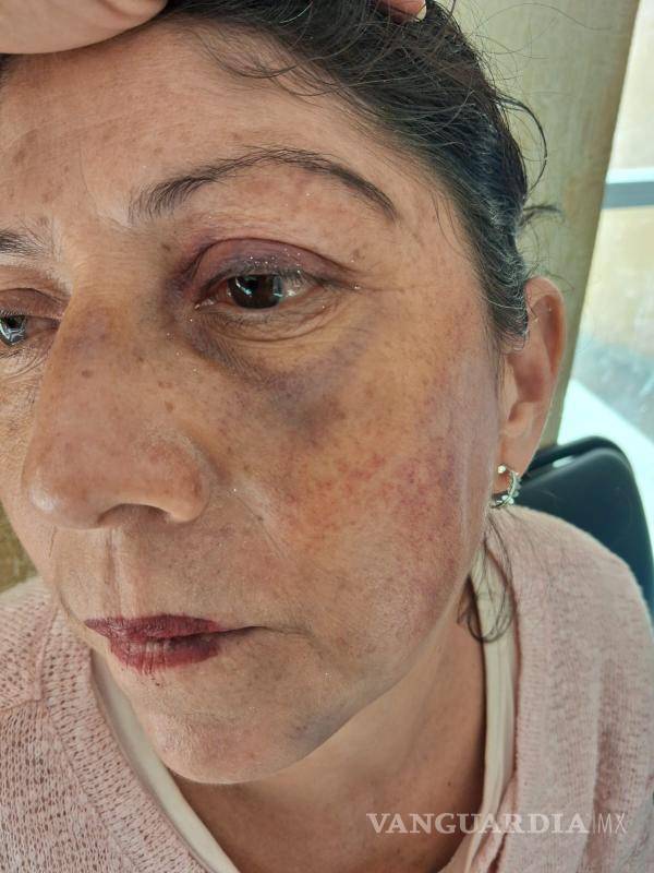 $!La afectada tenía seis meses internada cuando ocurrieron los hechos.