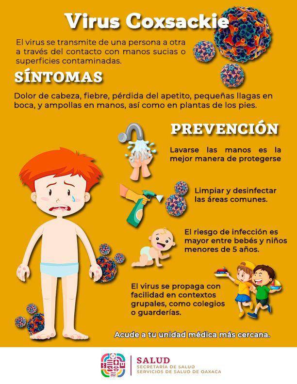 $!Surge brote de virus Coxsackie en Hidalgo, ¿Qué es, cuáles son los síntomas y cómo prevenir contagiarse de esta enfermedad que afecta principalmente a bebés y niños?