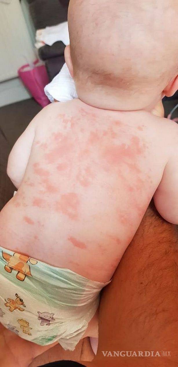 $!Bebé de 5 meses se contagió de coronavirus, ahora está enferma del corazón de por vida