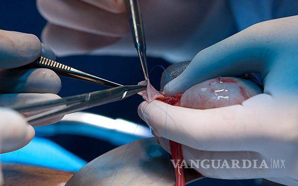 $!Los malos hábitos podrían desencadenar en complicaciones como la hemodiálisis e incluso la necesidad de un trasplante.